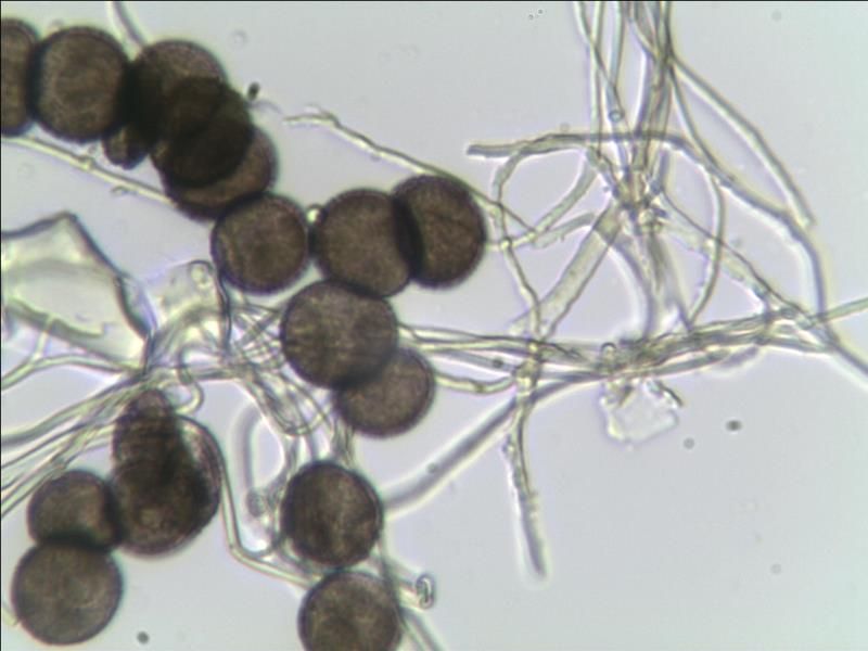 Diderma nivale.......